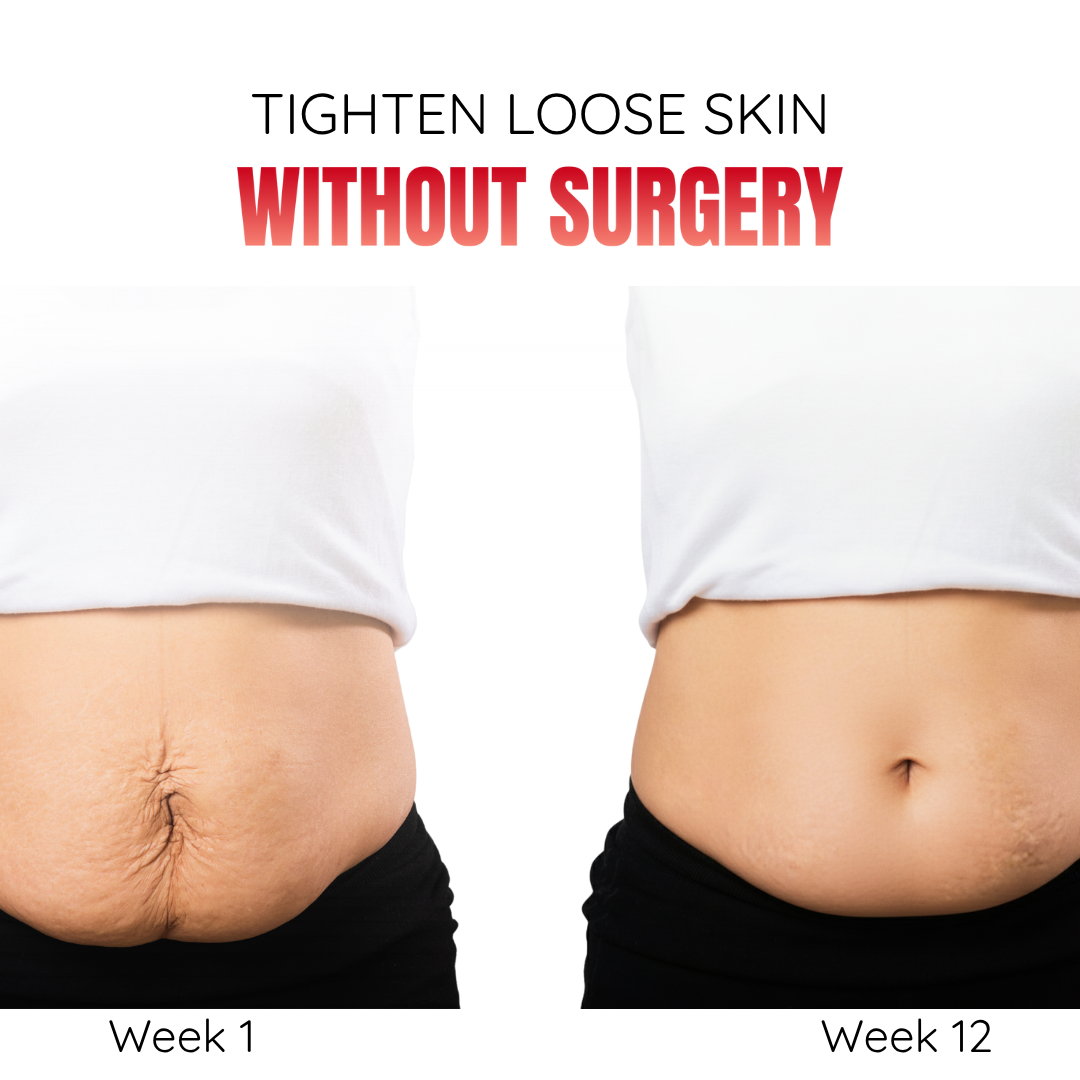 Cosmetific™ GlowBand